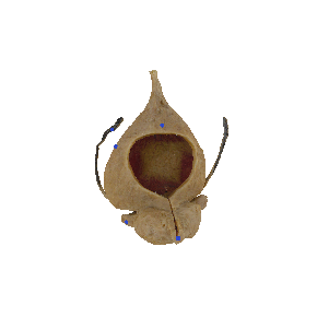 图5-6女性膀胱及尿道冠状切面（前面观）